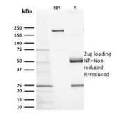 SDS-PAGE analysis of purified, BSA-free CD117 antibody (clone KIT/2673) as confirmation of integrity and purity.
