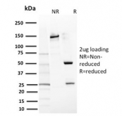 SDS-PAGE analysis of purified, BSA-free CD117 antibody (clone KIT/2669) as confirmation of integrity and purity.