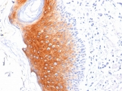 IHC staining of FFPE human skin with Cytokeratin 1 antibody (clone LHK1). HIER: boil tissue sections in pH 9 10mM Tris with 1mM EDTA for 20 min and allow to cool before testing.