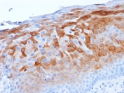 IHC staining of FFPE human cervix with Cytokeratin 1 antibody (clone LHK1). HIER: boil tissue sections in pH 9 10mM Tris with 1mM EDTA for 20 min and allow to cool before testing.