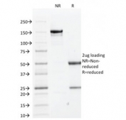 SDS-PAGE analysis of purified, BSA-free CK1 antibody (clone KRT1/1840) as confirmation of integrity and purity.