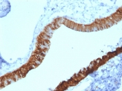 IHC staining of FFPE human ovary with Cytokeratin 3 antibody (clone KRT3/2130). HIER: boil tissue sections in pH 9 10mM Tris with 1mM EDTA for 20 min and allow to cool before testing.