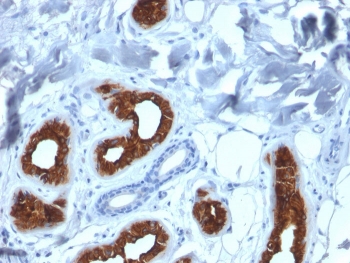 IHC staining of FFPE human skin with Cytokeratin 3 antibody (clone KRT3/2130). HIER: boil tissue sections in pH 9 10mM Tris with 1mM EDTA for 20 min and allow to cool before testing.