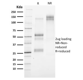 SDS-PAGE analysis of purified, BSA-free Cytokeratin 3 antibody (clone KRT3/2130) as confirmation of integrity and purity.