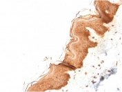 IHC staining of FFPE human skin with Cytokeratin 4 antibody (clone KRT4/2804). HIER: boil tissue sections in pH 9 10mM Tris with 1mM EDTA for 20 min and allow to cool before testing.