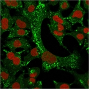 Immunofluorescent staining of permeabilized human A549 cells with Cytokeratin 4 antibody (clone KRT4/2804, green) and Reddot nuclear stain (red).