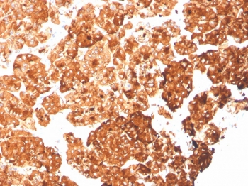 IHC staining of FFPE human pancreas with recombinant Cytokeratin 6A antibody (clone rKRT6A/2100). HIER: boil tissue sections in pH 9 10mM Tris with 1mM EDTA for 20 min and allow to cool before testing.~