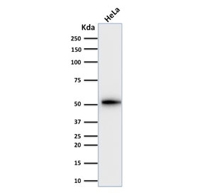 Western blot testing of human HeLa cell lysate with Cytokeratin 8 antibody (clone KRT7/2200). Predicted molecular weight ~51 kDa.