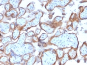 IHC staining of FFPE human placenta with Cytokeratin 7 antibody (clone KRT7/2200). HIER: boil tissue sections in pH 9 10mM Tris with 1mM EDTA for 20 min and allow to cool before testing.