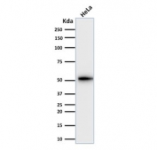 Western blot testing of human HeLa cell lysate with Cytokeratin 8 antibody (clone KRT7/2200). Predicted molecular weight ~51 kDa.