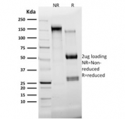 SDS-PAGE analysis of purified, BSA-free Cytokeratin 17 antibody (clone KRT7/2200) as confirmation of integrity and purity.