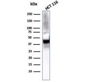 Western blot testing of human HCT116 cell lysate with Cytokeratin 8 antibody (clone KRT8/2115). Predicted molecular weight ~56 kDa.