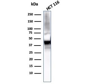 Western blot testing of human HCT116 cell lysate with Cytokeratin 8 antibody (clone KRT8/2115). Predicted molecular weight ~56 kDa.