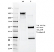 SDS-PAGE analysis of purified, BSA-free Cytokeratin 10 antibody (clone AE10) as confirmation of integrity and purity.