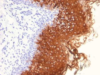 IHC staining of FFPE human skin with Cytokeratin 10 antibody (clone AE20). HIER: boil tissue sections in pH 9 10mM Tris with 1mM EDTA for 20 min and allow to cool before testing.~