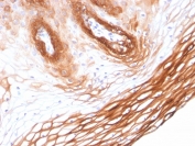 IHC staining of FFPE human skin with Cytokeratin 14 antibody (clone KRT14/2375). HIER: boil tissue sections in pH 9 10mM Tris with 1mM EDTA for 20 min and allow to cool before testing.