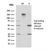 SDS-PAGE analysis of purified, BSA-free Cytokeratin 14 antibody (clone KRT14/2375) as confirmation of integrity and purity.