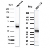 Western blot testing of human thymus tissue and HCT-116 cell lysate with CK15 antibody (clone KRT15/2957). Expected molecular weight ~50 kDa.