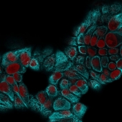 Immunofluorescent staining of MeOH-fixed human MCF7 cells with CK15 antibody (clone KRT15/2959, green) and Reddot nuclear stain (red).