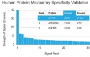 Analysis of HuProt(TM) microarray containing more than 19,000 full-length human proteins using CK15 antibody (clone KRT15/2959). These results demonstrate the foremost specificity of the KRT15/2959 mAb.<br>Z- and S- score: The Z-score represents the strength of a signal that an antibody (in combination with a fluorescently-tagged anti-IgG secondary Ab) produces when binding to a particular protein on the HuProt(TM) array. Z-scores are described in units of standard deviations (SD's) above the mean value of all signals generated on that array. If the targets on the HuProt(TM) are arranged in descending order of the Z-score, the S-score is the difference (also in units of SD's) between the Z-scores. The S-score therefore represents the relative target specificity of an Ab to its intended target.