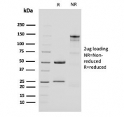 SDS-PAGE analysis of purified, BSA-free CK15 antibody (clone KRT15/2959) as confirmation of integrity and purity.