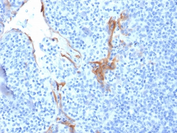IHC staining of FFPE human tonsil with Cytokeratin 16 antibody (clone LL025). HIER: boil tissue sections in pH 9 10mM Tris with 1mM EDTA for 20 min and allow to cool before testing.~