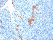 IHC staining of FFPE human tonsil with Cytokeratin 16 antibody (clone LL025). HIER: boil tissue sections in pH 9 10mM Tris with 1mM EDTA for 20 min and allow to cool before testing.
