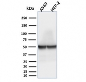 Western blot testing of human samples with recombinant Cytokeratin 18 antibody. Predicted molecular weight ~48 kDa.