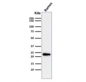 Western blot testing of human Ramos cell lysate with LMO2 antibody. Predicted molecular weight ~25 kDa.