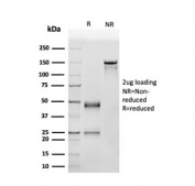 SDS-PAGE analysis of purified, BSA-free p53 antibody (SPM514) as confirmation of integrity and purity.