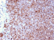 IHC staining of FFPE human lymph node with LSP1 antibody (clone LSP1/3025). HIER: boil tissue sections in pH 9 10mM Tris with 1mM EDTA for 20 min and allow to cool before testing.