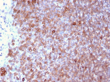 IHC staining of FFPE human lymph node with LSP1 antibody. HIER: boil tissue sections in pH 9 10mM Tris with 1mM EDTA for 20 min and allow to cool before testing.
