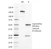 SDS-PAGE analysis of purified, BSA-free EpCAM antibody (clone EGP40/1373) as confirmation of integrity and purity.