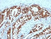 IHC staining of FFPE dog colon with EpCAM antibody (clone EGP40/1373). HIER: boil tissue sections in pH 9 10mM Tris with 1mM EDTA for 10-20 min and allow to cool before testing.