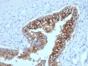 IHC staining of FFPE dog bladder with EpCAM antibody (clone EGP40/1373). HIER: boil tissue sections in pH 9 10mM Tris with 1mM EDTA for 10-20 min and allow to cool before testing.