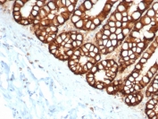 IHC staining of FFPE cat small intestine with EpCAM antibody (clone EGP40/1373). HIER: boil tissue sections in pH 9 10mM Tris with 1mM EDTA for 10-20 min and allow to cool before testing.