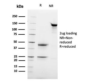 SDS-PAGE analysis of purified, BSA-free Desmoglein 3 antibody (clone DSG3/2837) as confirmation of integrity and purity.