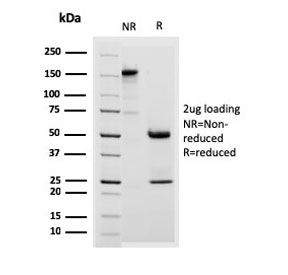 SDS-PAGE analysis of purified, BSA-free Desmoglein 3 antibody (clone DSG3/2838) as confirmation of integrity and purity.