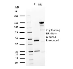 SDS-PAGE analysis of purified, BSA-free Desmoglein 3 antibody (clone DSG3/2839) as confirmation of integrity and purity.