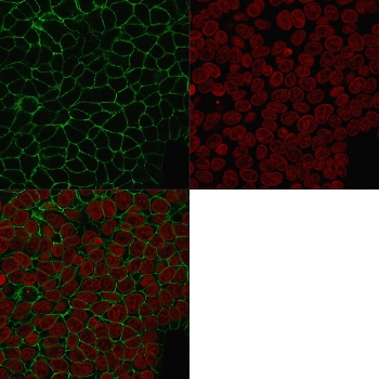 Immunofluorescent staining of human MCF7 cells with EpCAM antibody (clone HEA125, green) and Reddot nuclear stain (red).~