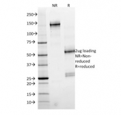 SDS-PAGE analysis of purified, BSA-free SMAD4 antibody (clone SMAD4/2524) as confirmation of integrity and purity.