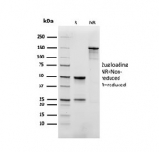 SDS-PAGE analysis of purified, BSA-free recombinant Myoglobin antibody (clone rMB/2105) as confirmation of integrity and purity.