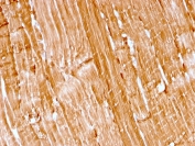 IHC staining of FFPE human skeletal muscle with recombinant Myoglobin antibody (rMB/2105). HIER: boil tissue sections in pH 9 10mM Tris with 1mM EDTA for 10-20 min and allow to cool before testing.