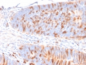 IHC staining of FFPE human colon with Myoglobin antibody (CPTC-MBD1-1). HIER: boil tissue sections in pH 9 10mM Tris with 1mM EDTA for 10-20 min and allow to cool before testing.
