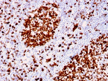 IHC staining of FFPE human tonsil with MCM6 antibody. HIER: boil tissue sections in pH 9 10mM Tris with 1mM EDTA for 20 min and allow to cool before testing.