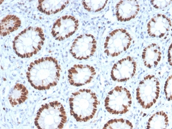 IHC staining of FFPE human colon with MCM6 antibody. HIER: boil tissue sections in pH 9 10mM Tris with 1mM EDTA for 20 min and allow to cool before testing.