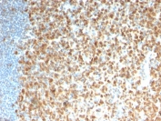 IHC testing of FFPE human tonsil with recombinant MCM7 antibody (clone rMCM7/1468). Required HIER: boil tissue sections in pH 9 10mM Tris with 1mM EDTA for 10-20 min.
