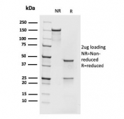 SDS-PAGE analysis of purified, BSA-free recombinant MCM7 antibody (clone rMCM7/1468) as confirmation of integrity and purity.