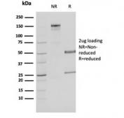SDS-PAGE analysis of purified, BSA-free MDH1 antibody (clone CPTC-MDH1-1) as confirmation of integrity and purity.