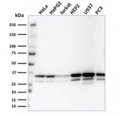 Western blot testing of human samples with MDH1 antibody (clone CPTC-MDH1-1). Predicted molecular weight: ~36 kDa.